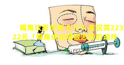 嘴角纹新价来 🐼 袭仅需22322元「嘴角纹出现做怎样的动作才能减轻」